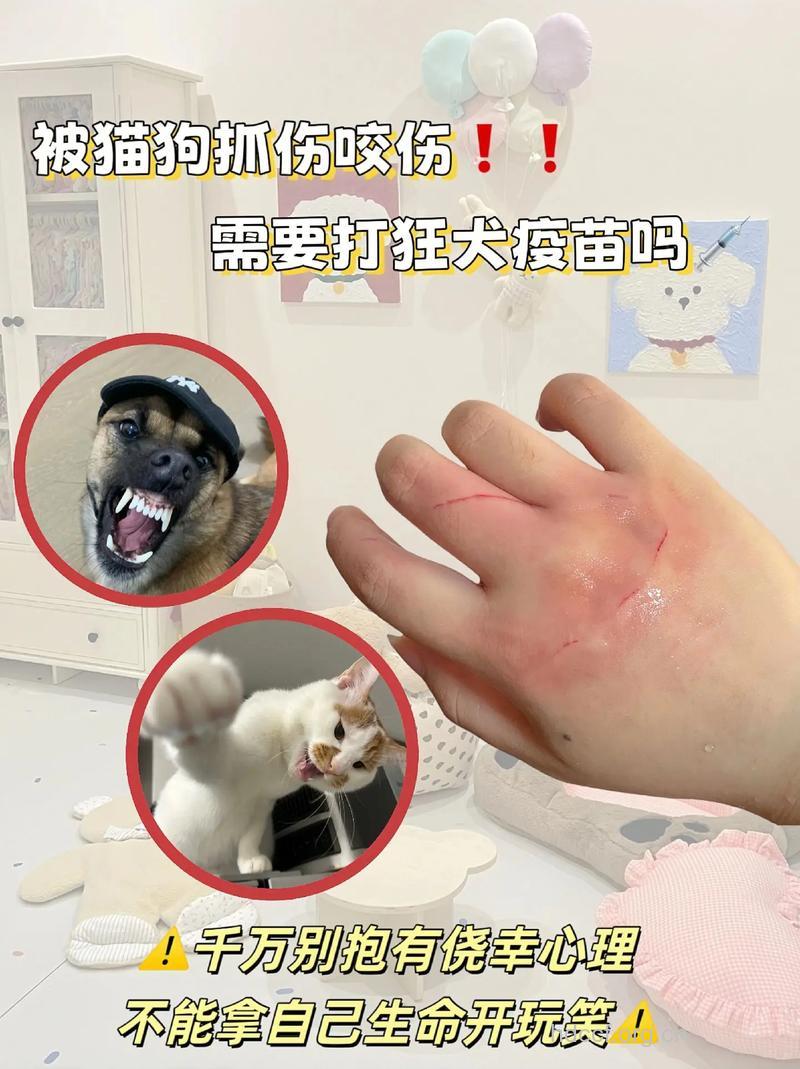 被宠物抓、咬伤 不可掉以轻心