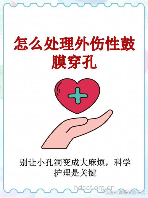 鼓膜外伤破裂穿孔怎么办?