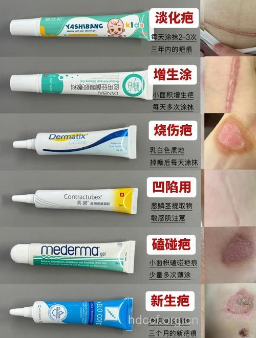 消除瘢痕 用药还是手术?