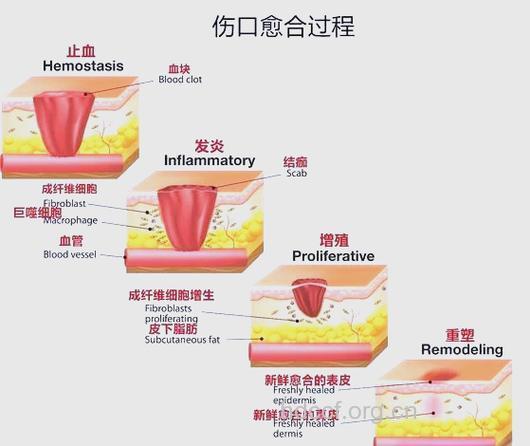 外伤的中西医治疗禁忌