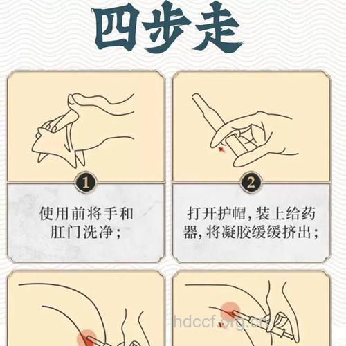 痔疮的内服外熏治疗法