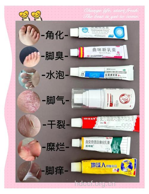 足癣的治疗用药