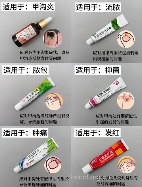 修脚导致甲沟炎 怎么治疗用药?