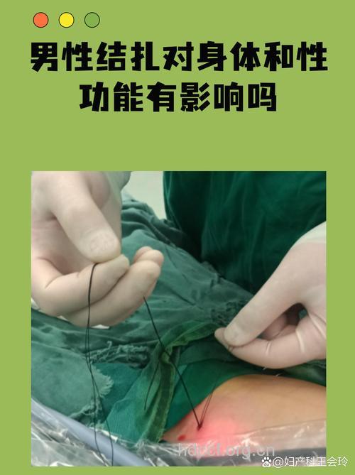 口服避孕效果不亚于结扎