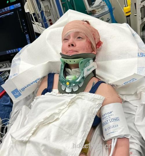 颈椎病按摩 竟致高位截瘫