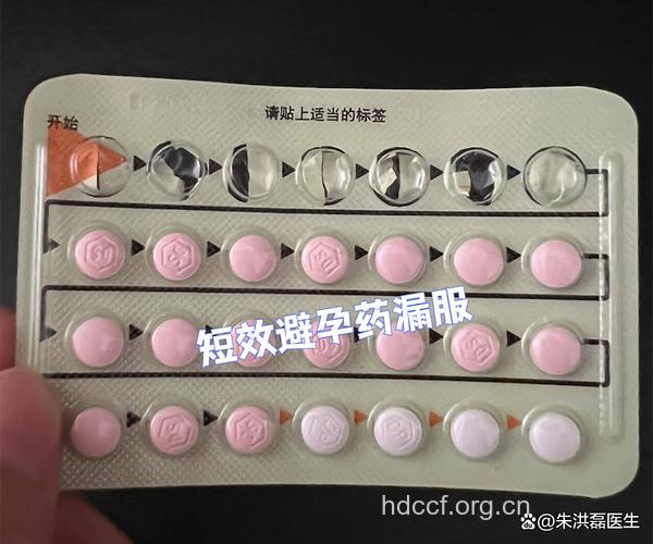 突然停服避孕药,可引起短暂性脱发