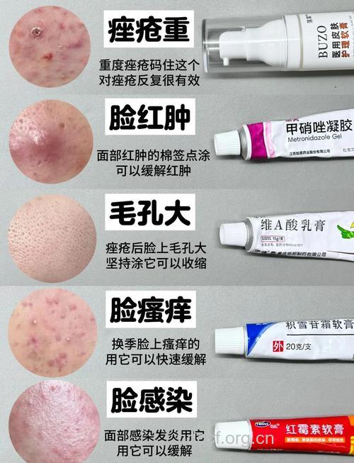 脸部得了皮肤病 用药需谨慎