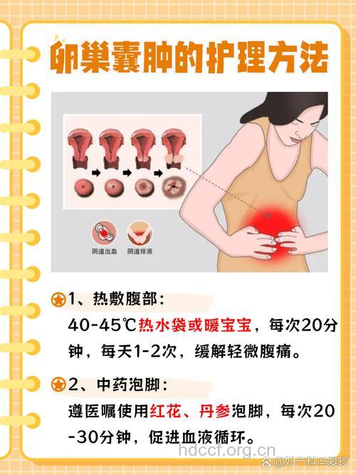 卵巢囊肿的保守治疗方法
