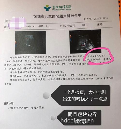 怀孕后仍服避孕药 宝宝检出肝母细胞瘤