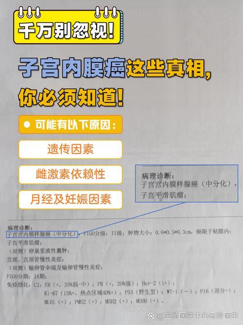 长效孕激素治疗子宫内膜癌