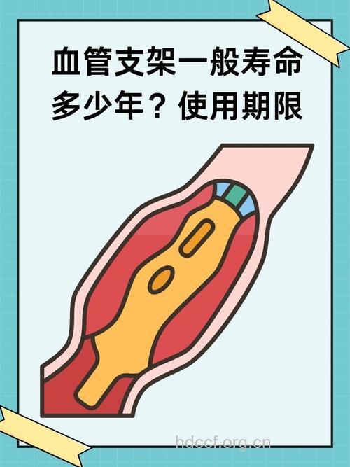 心脏支架的寿命是几年