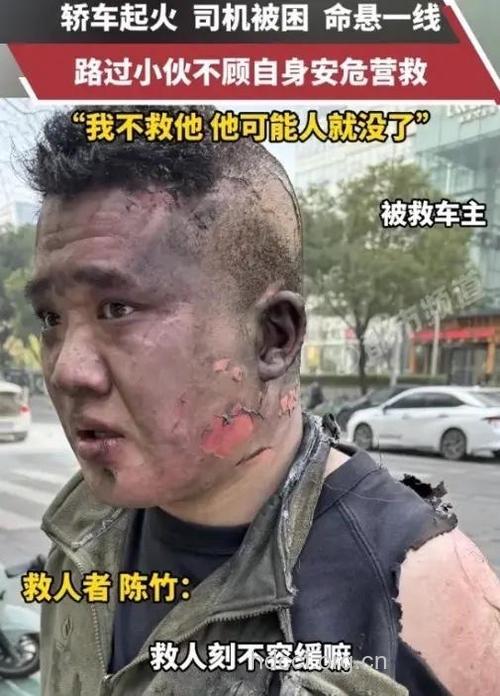 专车司机弃单救老人 老人突然流鼻血是何因