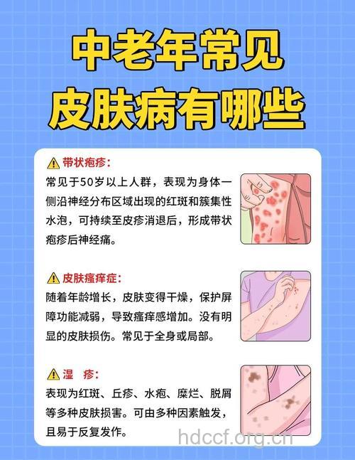 夏季皮肤疾病保卫战你准备好了吗?