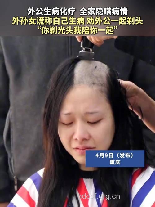 妙龄女遭遇“鬼剃头”专家献策