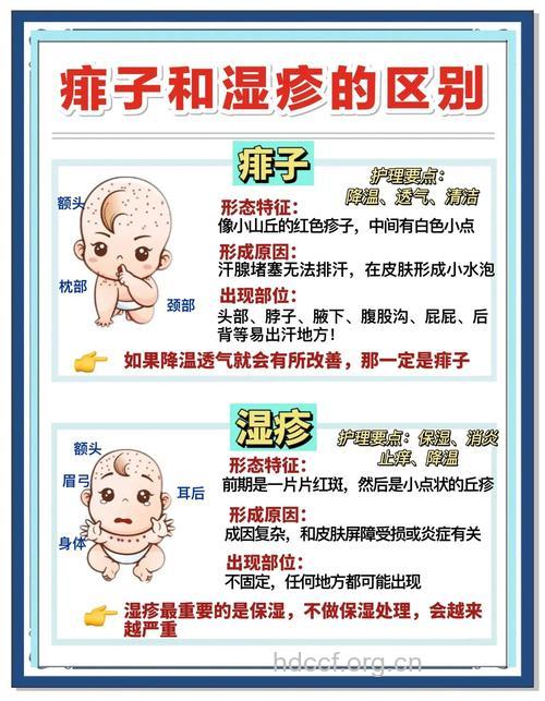 小儿长痱子该怎么治疗?