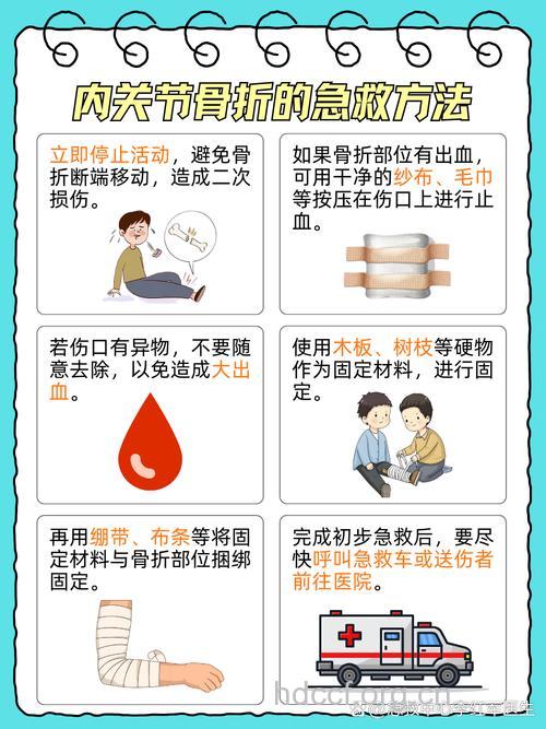骨折应如何急救 哪些原因易导致骨折