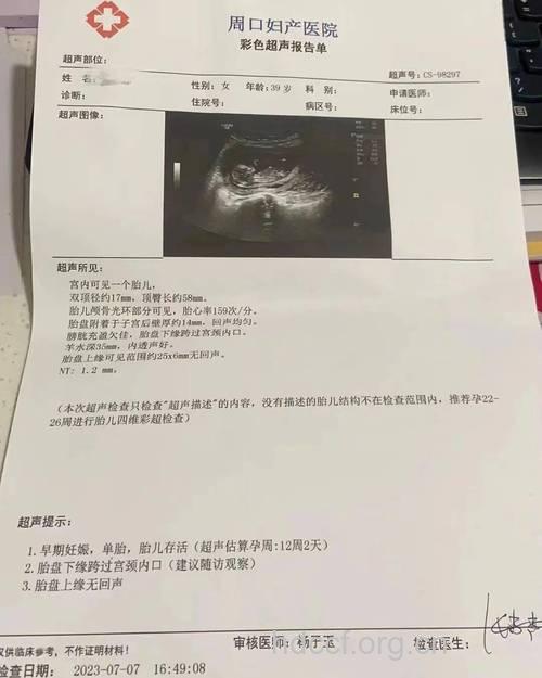 备孕两年没怀上 可能是生殖器结核“使坏”