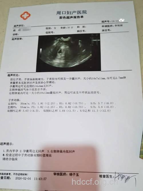 备孕6个月后 我终于升级成功怀孕了