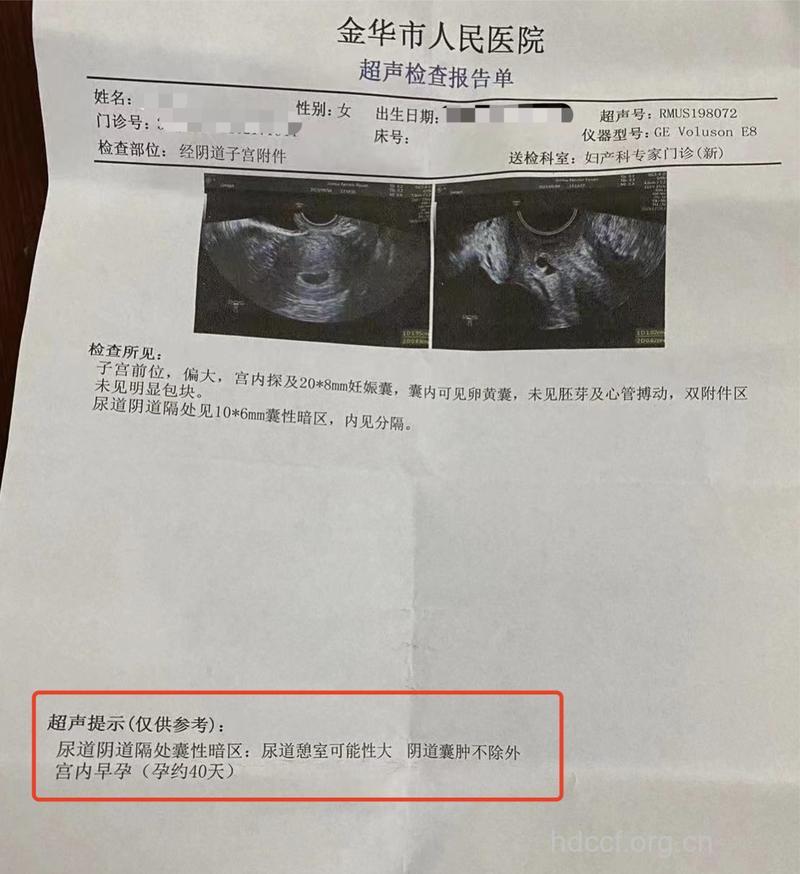 怀孕3个月能打胎吗