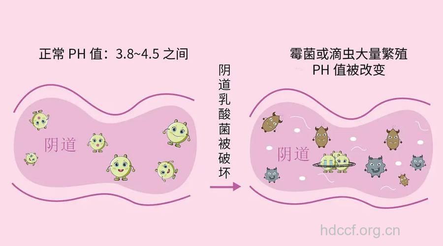 爱吃甜食的女性易患阴道炎