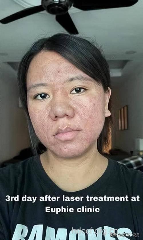 女人荷尔蒙紊乱会毁容 需及时调节
