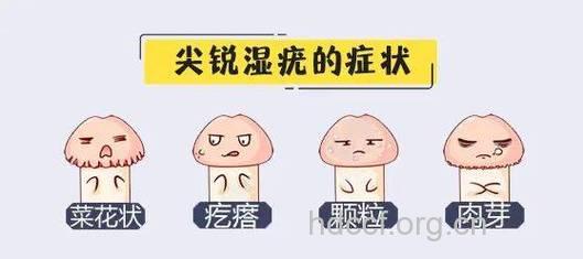 为啥男人生殖感染老复发