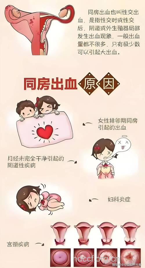 同房过程出现生殖器外伤怎么办?
