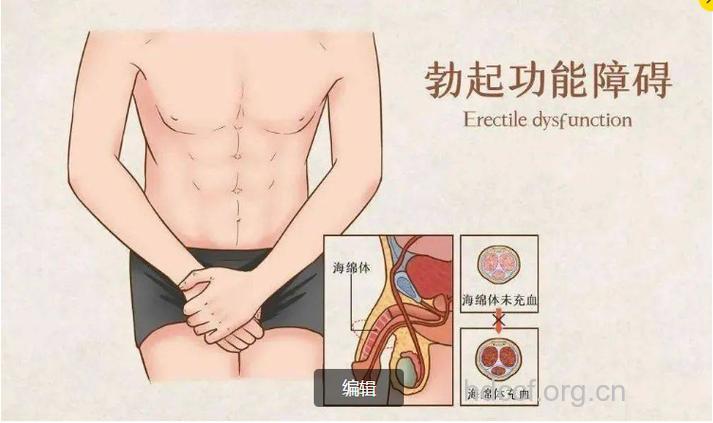 强荐:男人阳痿的四大保健疗法