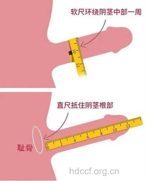 导致男人阴茎短小的原因