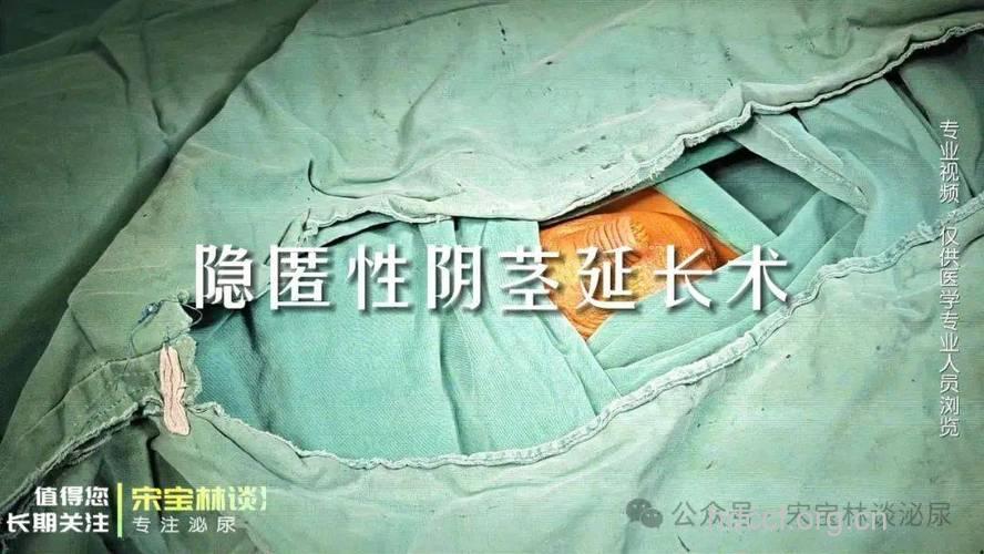 男人做阴茎延长术前心里都在想什么