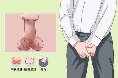 生殖感染会导致男性不育