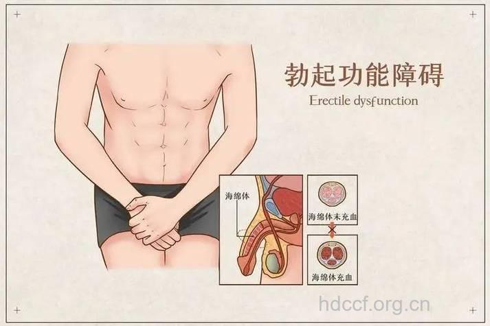 6个方法提高阴茎勃起硬度 让男性信心加倍