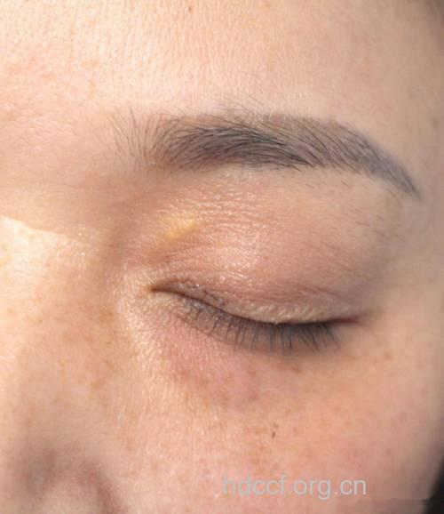 怎么样看男人肾好不好 头发出卖你