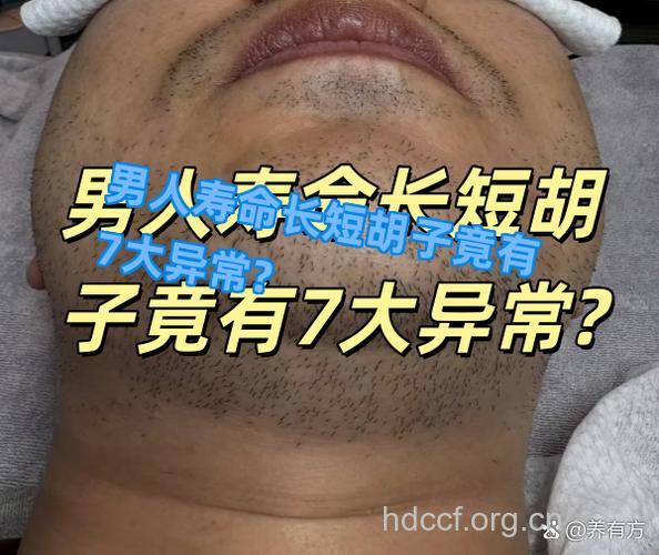 男人胡子少或脱落 性功能受损信号