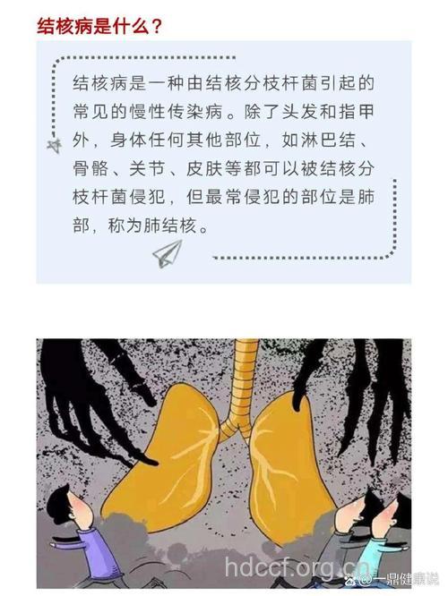 结核病-本世纪的大瘟疫