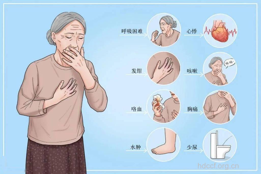 老年人心律失常的表现