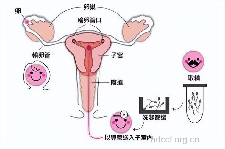 免疫性不孕可能与性交过频有关