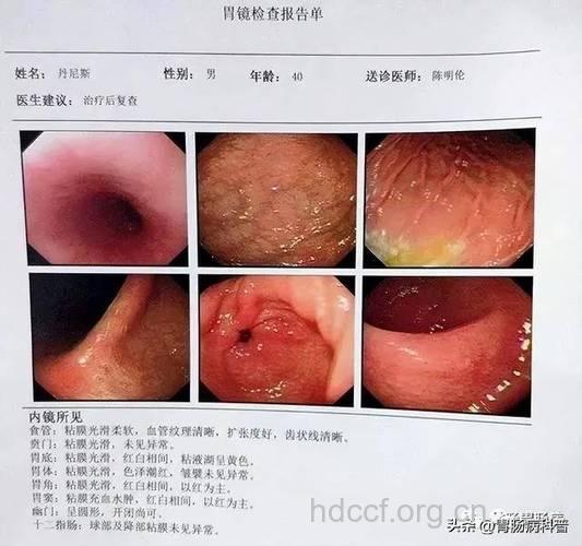 胃部B超与胃镜有何区别